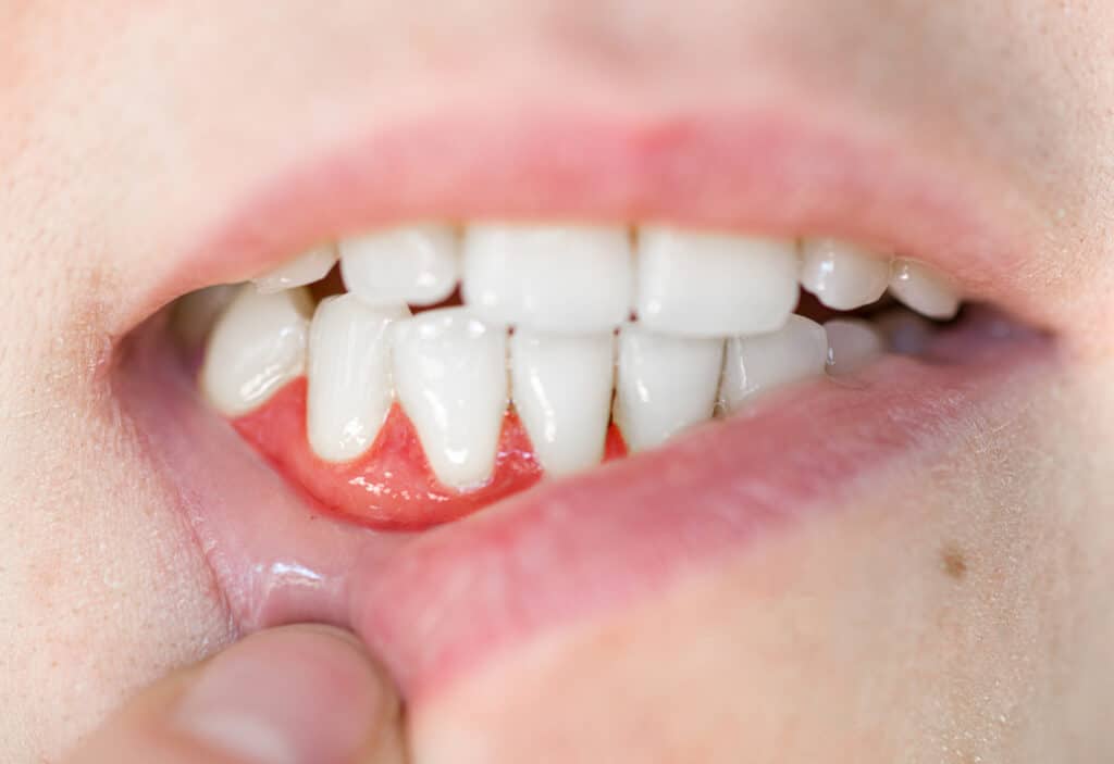 Answering all your ‘Can gum disease…’ queries